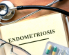 Understanding Endometriosis and Fertility: A Comprehensive Exploration